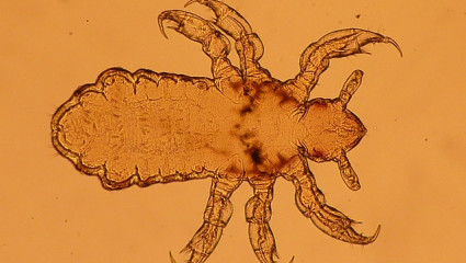 LES POUX : LEUR RENTREE, C’EST TOUTE L’ANNEE !